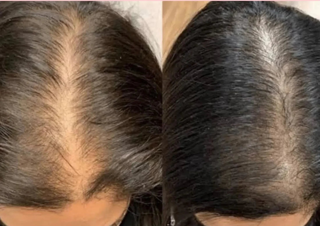Hair Growth Oil – Natural Regrowth Treatment for All Hair Types