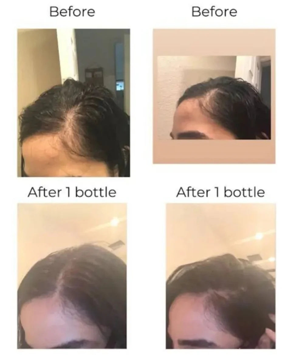 Hair Growth Oil – Natural Regrowth Treatment for All Hair Types